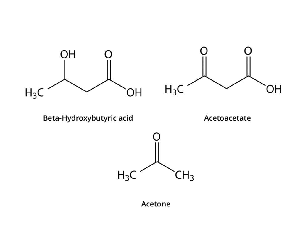 ketone bodies structure acetoacetate acetone beta-hydroxybutyrate